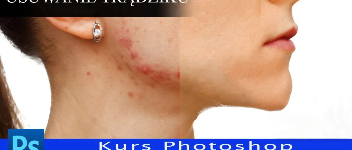 Retusz twarzy. Usuwanie trądziku - kurs photoshop